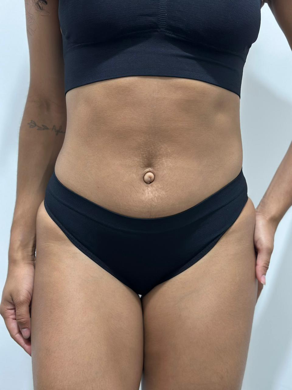 CALCINHA BIQUÍNI 20010 - SELENE